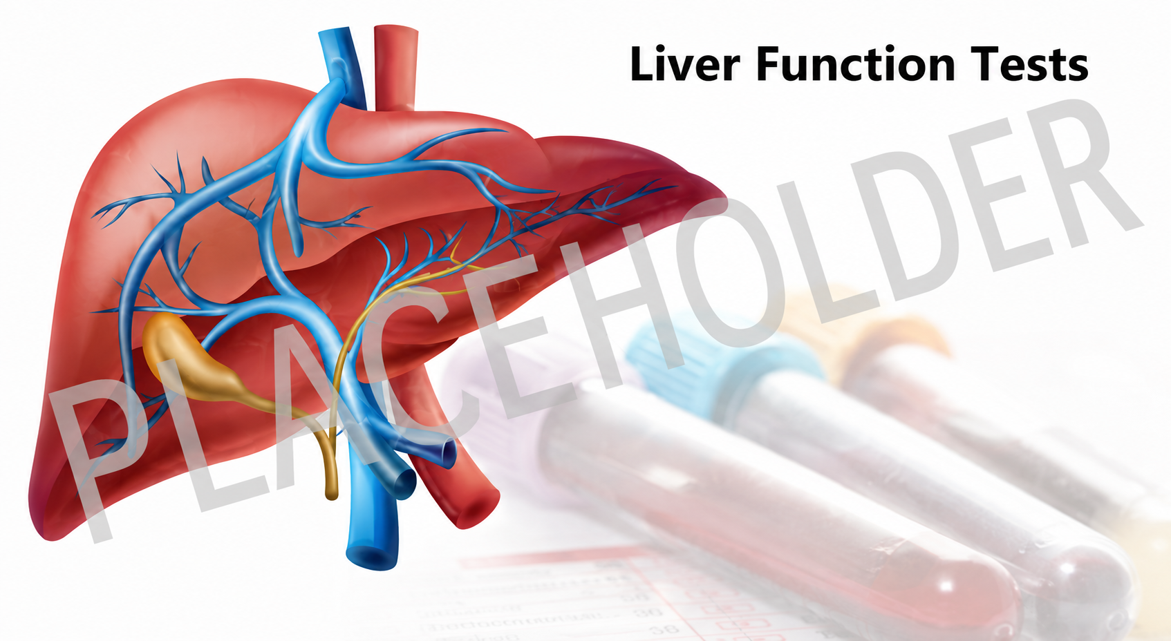 Fatty Liver Diagnosis