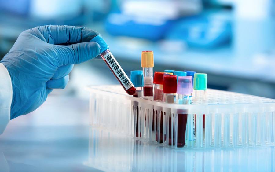 Routine Tests